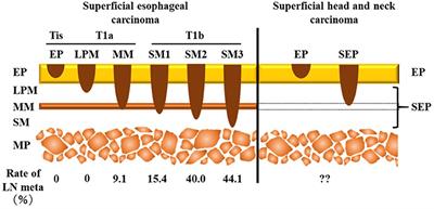 Predicting Cervical Lymph Node Metastasis Following Endoscopic Surgery in Superficial Head and Neck Carcinoma